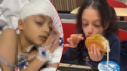 Okulda düştüğü iddia edilen Mira yaşam savaşı veriyor: Babadan korkunç iddia! 'Öğretmeni dövdü' - gundem