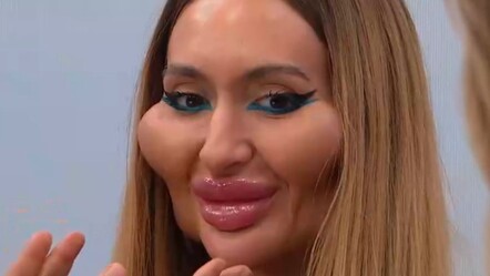 Estetik bağımlısı model Anastasia Pokreshchuk gerçek mesleğini açıkladı, duyanlar çok şaşırdı - magazin