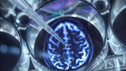 Alzheimer teşhisinde ‘yapay zeka’ devrimi: Tükürük örneğiyle ortaya çıkacak - gundem