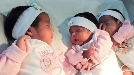 Milyonda bir ihtimal doğal yolla gebelikte tek yumurta üçüzleri - saglik