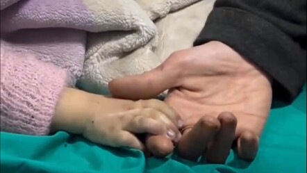 Gazze'de açlıktan ölen çocuk sayısı artıyor! 15 çocuk can verdi, 6'sı ölümün eşiğinde - dunya