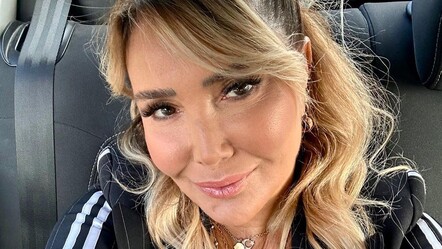 Eski halini unutun! Yonca Evcimik güzelleşmek için yaptırdığı işlemi açıkladı - magazin