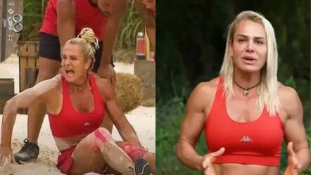 Survivor Nagihan sakatlığı nedeniyle yok! Nagihan Karadere'nin durumu belirsizliğini koruyor - haberler
