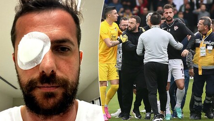 Retinası yırtılan Uğur Demirok, Bodrumspor - Eyüpspor maçındaki kavgayı anlattı - spor