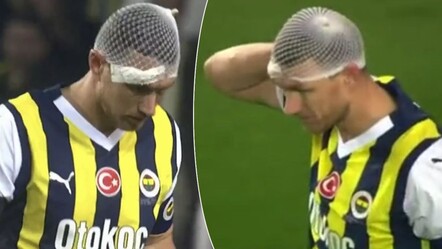 Fenerbahçe'de Edin Dzeko korkuttu! Boşnak golcü bir anda yere yığıldı - spor