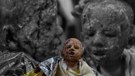 Çocukluğunu yaşayamadı... Gazzeli 4 yaşındaki Seca Cuneyd’in yürek yakan çığlıkları - gundem