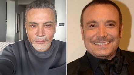 Değişimiyle ağızları açık bırakan Cenk Eren'in estetik için ödediği ücret ortaya çıktı - gundem