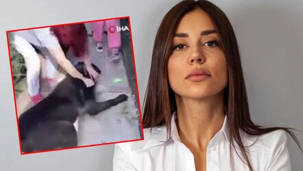 Fenomen Banu Parlak’ın 'tasmasız' köpeği komşusunun yavru köpeğini öldürdü - gundem