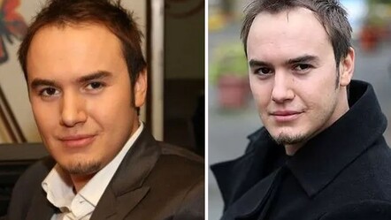 Saç ektiren Mustafa Ceceli son halini paylaştı, görenler yorum yapmadan edemedi - magazin