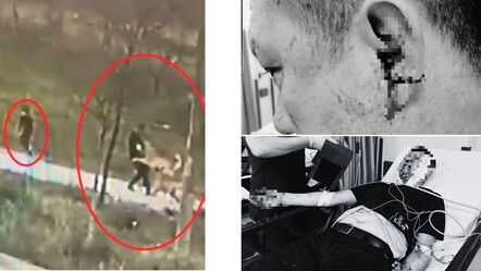 Başıboş köpek dehşeti kamerada! Çenesi kırıldı, etleri parçalandı, 30 dikiş atıldı - dunya