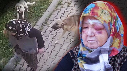 Başıboş köpek dehşeti! Yaşlı kadın tanınmaz hale geldi - gundem