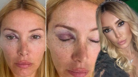 Eşinden şiddet gördüğünü açıklayan Yeşim Erçetin yaşadıklarını anlattı: ‘Bana uğursuz geldin’ deyip kafamı itti - magazin