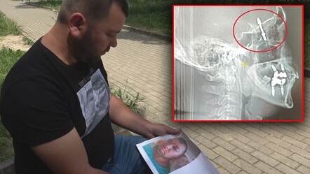 Bursa'da kan donduran olay! Amerika'da dergilere konu oldu... Dişini yaptırmak istedi, ölümden döndü - gundem