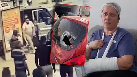 Tokat'ta park kavgası kanlı bitti: Magandalar, kadını hastanelik etti - gundem