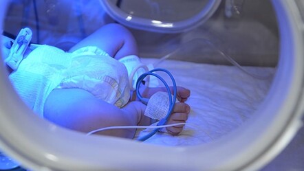 Devleti 'bebekler' üzerinden soydular! Her biri için günlük 8 bin lira ödeme yapıldı... - gundem