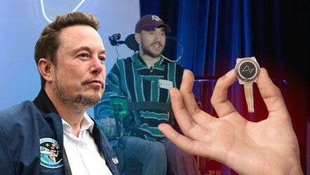 Elon Musk'ın Neuralink projesinde Arıza: İlk implantlı hastada sorunlar başladı! - spor