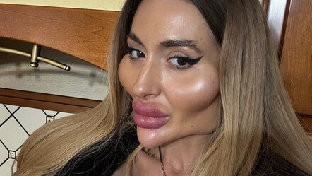 Elmacık kemikleriyle gündem olan Anastasia Pokreshchuk’un estetiksiz hali ortaya çıktı - magazin