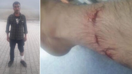 Köpek terörü hayatını kararttı! Benzin alırken ısırıldı, çalışamaz hale geldi - gundem