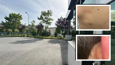 Okul müdürünün bahçede beslediği köpekler öğrenciye saldırdı! Aileye yalan söylediler - gundem