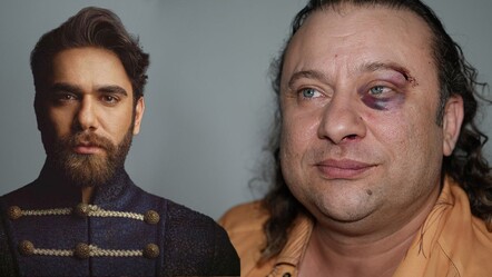 Onur Akay saldırıya uğradı! Kadir Doğulu iddiası gündem oldu - gundem