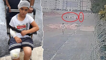 5 sene önce 8 köpeğin saldırısına uğrayan Yasin Alökmen'in acısı dinmiyor - gundem