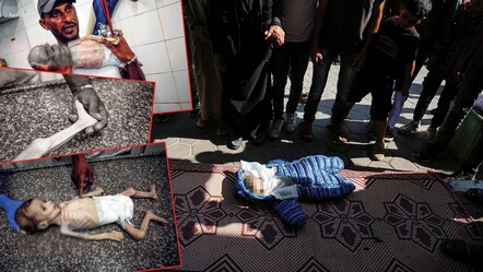 İsrail, Filistinlileri açlığa mahkum etti! 7 aylık bebeğin görüntüsü tüyleri diken diken etti - magazin