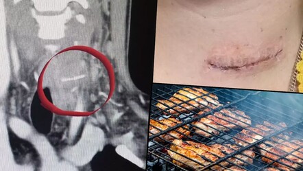 Mangala attığı tavuk hayatını kararttı! Bir haftada eridi, korkunç gerçek sonradan ortaya çıktı - dunya