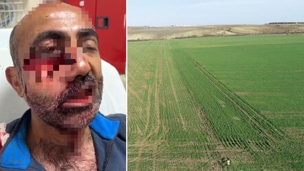 Hakkari'de iki ayının saldırısına uğrayan adamın yüzü parçalandı - gundem