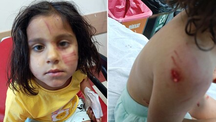 Başıboş köpeklerin saldırısına uğrayan çocuk yaralandı - gundem
