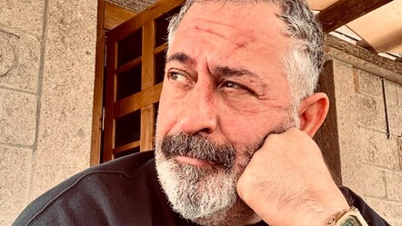 Cem Yılmaz sağ gözünde görme kaybı olduğunu açıkladı - magazin