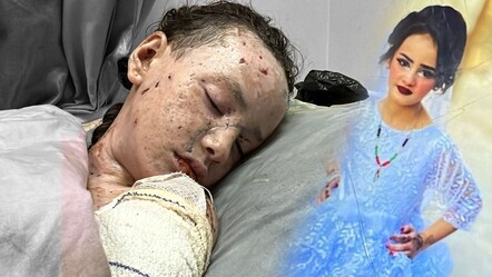Gazze'de son durum... Yürek yakan kare... 9 yaşındaki Hanan Alaa Akl yaşam mücadelesi veriyor! - dunya