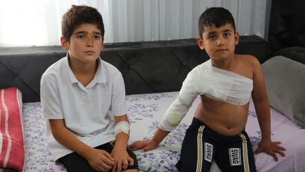 Bahçede oynarken sahipsiz köpeklerin hedefi oldular! İki kardeşi çevredekiler kurtardı - gundem