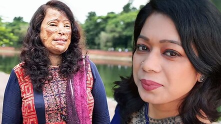 Asitli saldırıya uğrayan kadın 15 yaşındayken kabusu yaşadı! Yıllar sonra yaptığıyla takdir topluyor - gundem