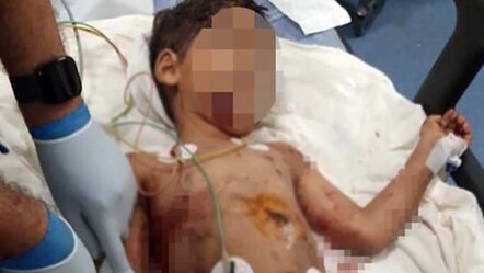 Başıboş sokak köpekleri 5 yaşındaki çocuğa saldırdı! Durumu kritik - gundem