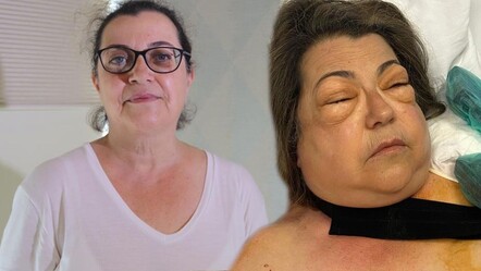 Mide bulantısı ile hastaneye gitti, yüzü gözü tanınmaz hale geldi! Gerçek ortaya çıktı - saglik