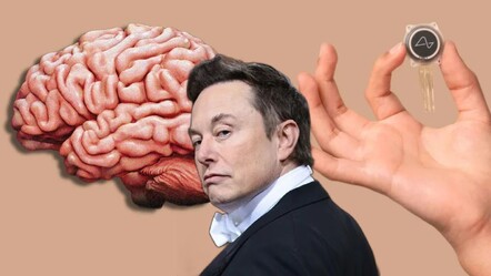 Elon Musk tarih verdi! 2026'ya kadar 1000'den fazla insana çip takılacak - spor