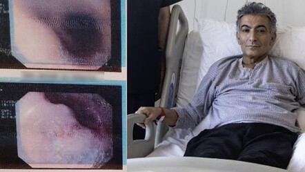 Yemek yiyememe şikayetiyle gitti, gerçeği öğrendi! 6 ameliyat sonra sağlığına kavuştu - saglik