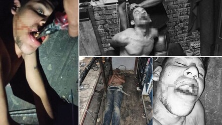 Antalya'ya çalışmak için giden Şanlıurfalı Vedat Kurt'a elektrik verilerek, dişi kırılarak ve böcek yedirilerek işkence yapıldı - gundem