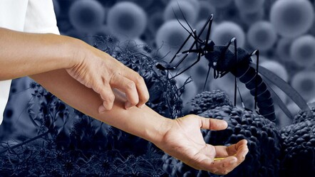 Batı Nil virüsü İsrail'i vurdu! Çok sayıda ölü var - dunya