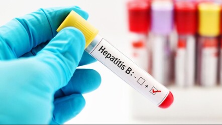 Dünyada 240 milyon kişi Hepatit bombası gibi... - saglik