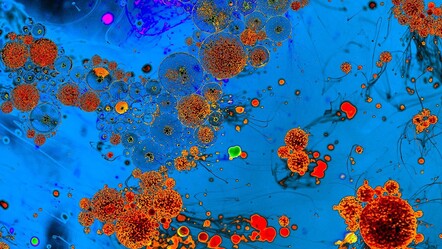 Kirli yiyecek ve sudan bulaşıyor! Her 3 kişiden 1’inde görülüyor: Belirti vermeden sinsice ilerliyor - dunya