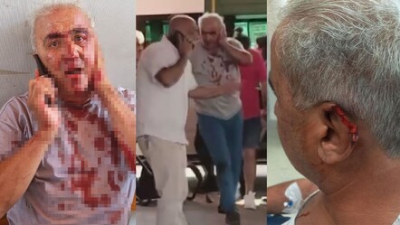 Kavga çıkaran söz! Minibüs şoförünün kulağını ısırarak koparttı - gundem