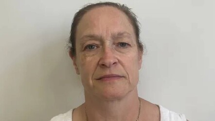 Çamaşır asarken örümcek ısırdı! Karnında kocaman bir delik oluştu - magazin