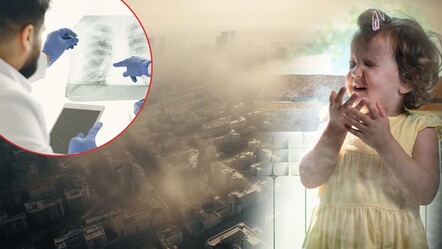 Hava kirliliği her yıl 7,5 milyondan fazla kişinin ölümüne yol açtı! Dünya Temiz Nefes Günü 'görünmeyen katil'in bilinmeyen istatistiklerini gündeme getirdi - dunya