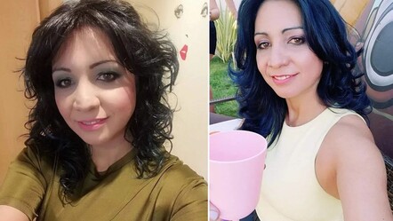 Estetik için Türkiye'ye gelen İspanyol kadın, ameliyattan 1 gün sonra öldü - gundem