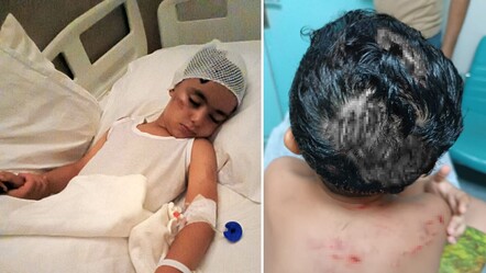 Ölümden dönen Cihan'ın tek bir isteği var: Sokak köpeklerinin hepsi toplanmalı - gundem