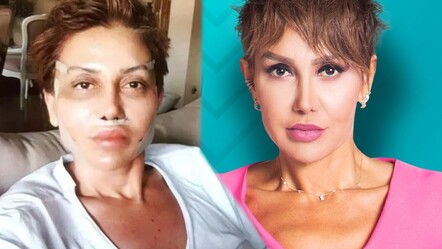 Serap Paköz’den estetik çıkışı: ‘Yaptırmadım’ diyenlere gülüyorum - magazin