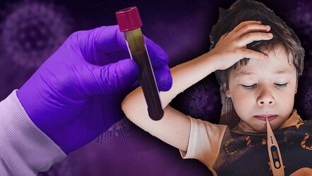 Vakalarda patlama yaşanıyor! ABD'de yeni kâbus parvovirüs B19: 5-9 yaşları arasındaki çocukları vuruyor! - Dünya