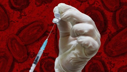 Maymun çiçeği hastalığı Türkiye'de görüldü mü? Bakanlık'tan 'mpox' açıklaması - saglik