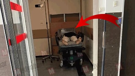 Sakarya'da maymun çiçeği virüsü vakası mı görüldü? Jet açıklama geldi - gundem